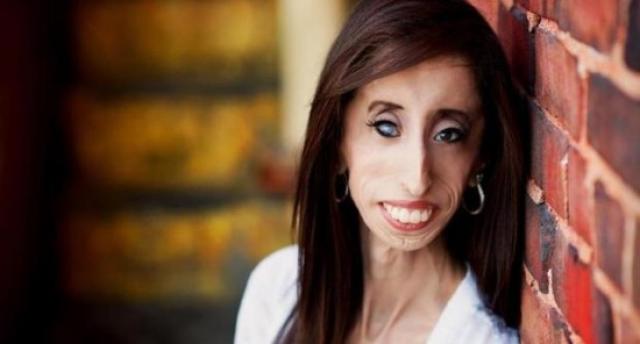 Lizzie Velasquez