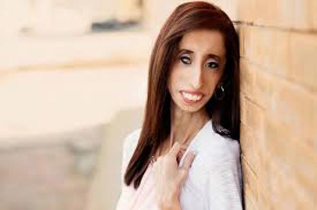 Lizzie Velasquez