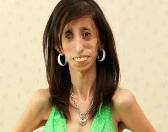 Lizzie Velasquez