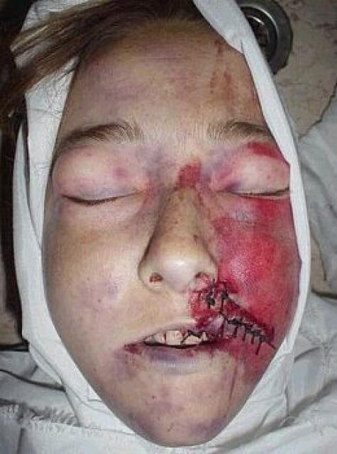Rachel Corrie