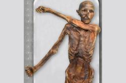  Otzi