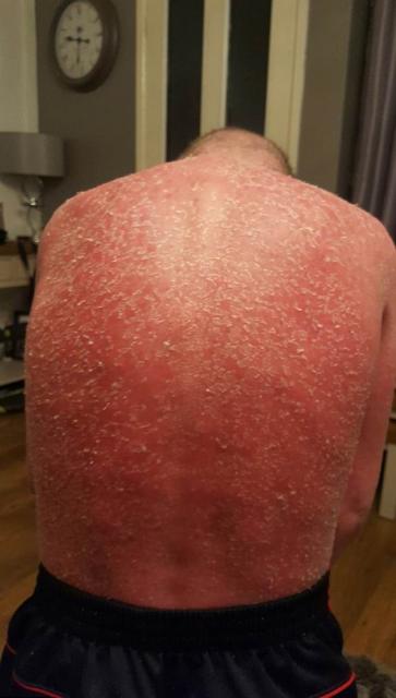 Джек Олдакрес фото Джек Олдакрес