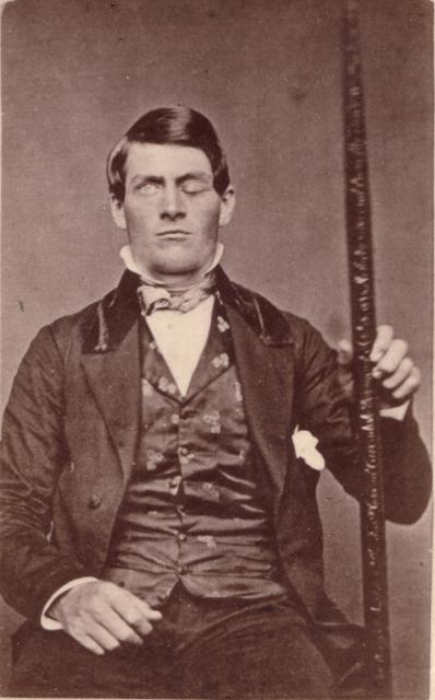 Phineas P. Gage photo Phineas P. Gage